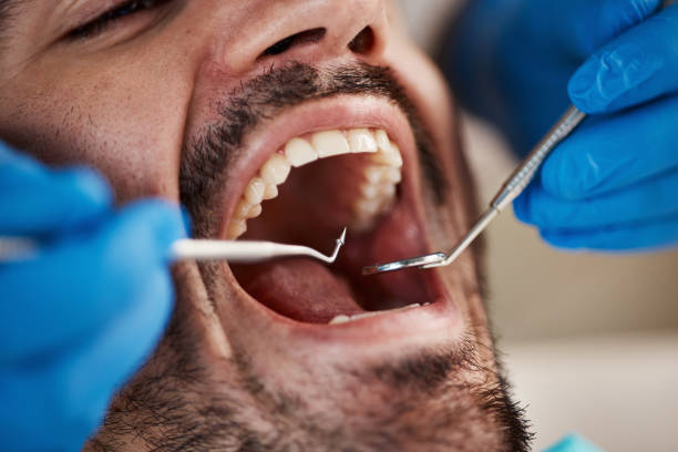 Best Oral Cancer Screening  in Eufaula, OK